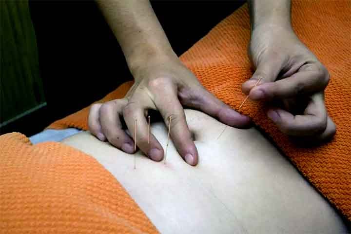 No Brasil, estima-se que mais de 3 milhões de pessoas utilizem a acupuntura regularmente, seja para tratar dores crônicas, ansiedade, insônia ou outras condições