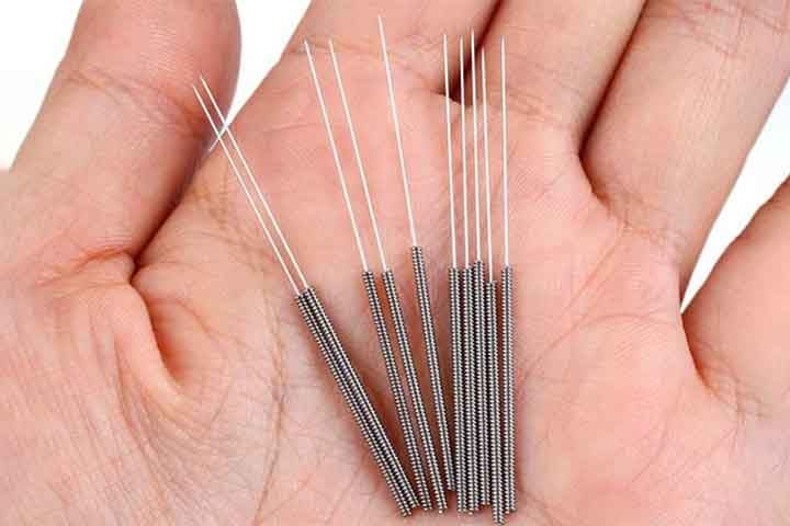 As agulhas usadas na acupuntura são finas, estéreis e descartáveis, geralmente feitas de aço inoxidável. Elas variam em comprimento e espessura, dependendo da região do corpo a ser tratada. 