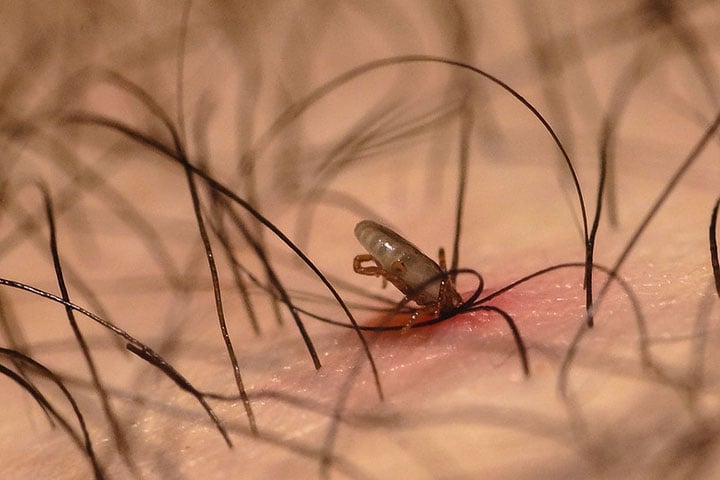 Um programa de banhos regulares com produtos para carrapatos deve ser seguido para eliminar os insetos e evitar novas infestações. 