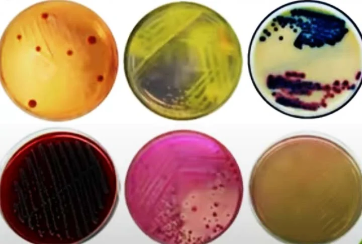 Koch também desenvolveu métodos e técnicas laboratoriais, como a cultura de bactérias em meios sólidos e o uso de corantes para a visualização microscópica de microrganismos, que são práticas padrão até hoje