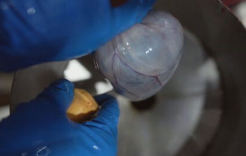 Nos frigoríficos, no processo de abate, as vesículas são retiradas do animal e furadas para a verificação da presença (ou não) dos cálculos biliares. 