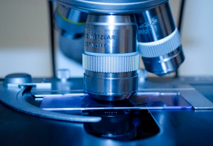 Em geral, os médicos analisam o ABCD da mancha e, caso desconfiem, aspiram um pedaço e enviam para a biópsia. No laboratório, há a confirmação ou não da doença. 