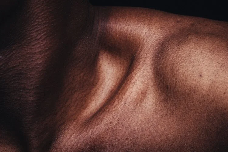 Quanto mais superficial for o enxerto, mais rápida e melhor será a regeneração da área doadora.