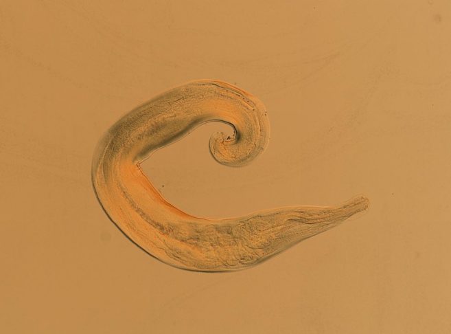 Oxiúro (Enterobius vermicularis): Parasita intestinal que causa coceira anal e insônia, principalmente em crianças. A transmissão ocorre pela ingestão de ovos presentes em alimentos e objetos contaminados.