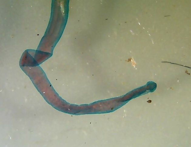 Hymenolepis nana: Cestódeo causador da himenolepidíase, doença intestinal que afeta principalmente crianças. Transmissão ocorre pela ingestão de ovos presentes em alimentos e objetos contaminados.