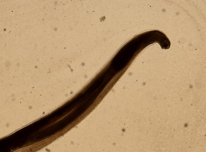 Amarelão (Ancylostoma duodenale e Necator americanus): Ancilostomídeos que causam anemia ferropriva, fraqueza e desnutrição. A transmissão ocorre pelo contato da pele com solo contaminado por larvas, principalmente em áreas com saneamento básico precário.