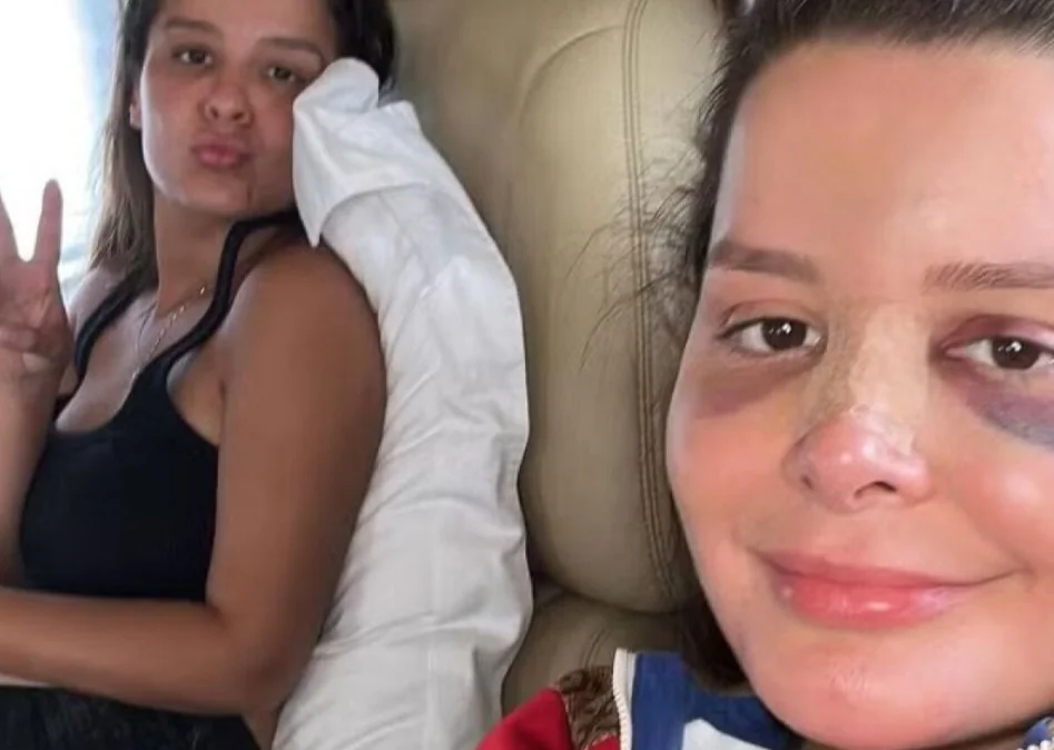 Em março de 2024, a cantora sertaneja Maraisa, que faz dupla com Maiara,  sofreu um acidente num resort em Porto de Pedras, em Alagoas,  e precisou ser levada para o hospital. Ela estava numa banheira jacuzzi e quebrou o nariz. 