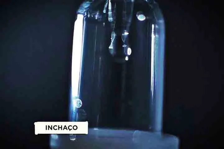 Essa superprodução de cortisol levou Sabrina a sofrer com a Síndrome de Cushing - doença endócrina provocada por elevados níveis do hormônio no organismo.