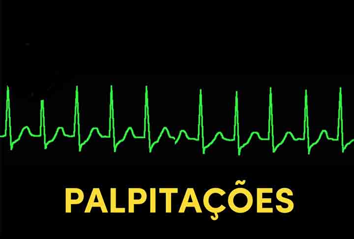 É preciso destacar que boa parte das arritmias não tem uma causa bem definida, sendo algumas de nascença. Outras são em virtude de problemas no músculo do coração, como infarto, insuficiência cardíaca ou doença de Chagas. 