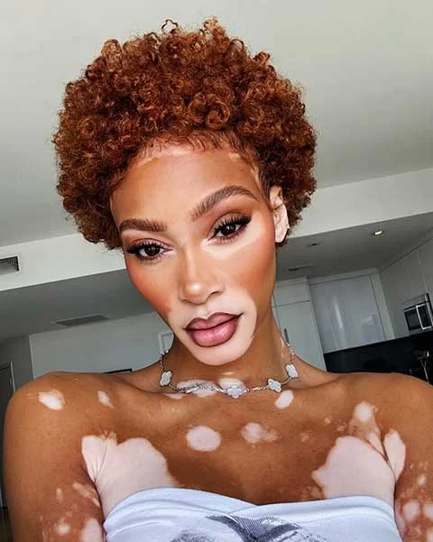 A canadense Winnie Harlow surpreende com 91,26% de simetria facial, segundo o ranking de De Silva. Seu nariz recebeu avaliação altíssima: 96,9%.