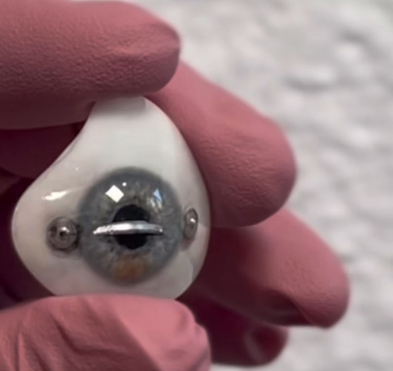 A resposta para essas perguntas é bem simples. Bree não tem um globo ocular e o olho, na verdade, trata-se de uma prótese.