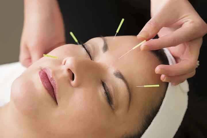 A acupuntura é uma técnica terapêutica da medicina tradicional chinesa que consiste na aplicação de agulhas em pontos específicos do corpo para estimular o equilíbrio energético e tratar diversas condições de saúde.