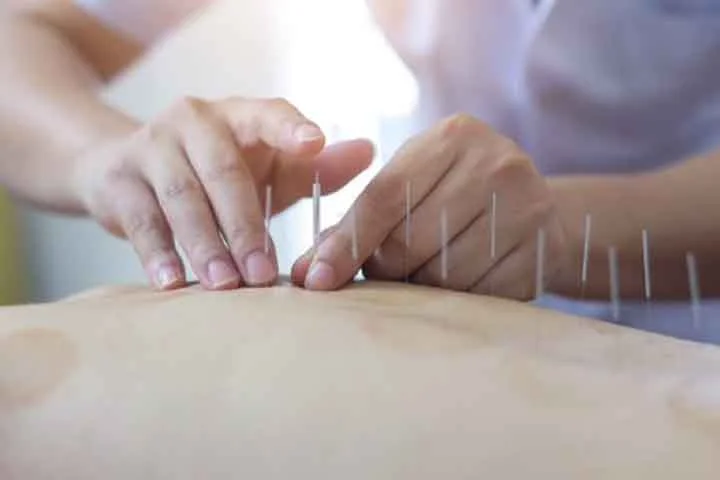 No Ocidente, países como Estados Unidos, Alemanha, França e Brasil também adotaram a acupuntura, com reconhecimento crescente na medicina integrativa e complementar. A OMS recomenda sua prática em diversos contextos clínicos.