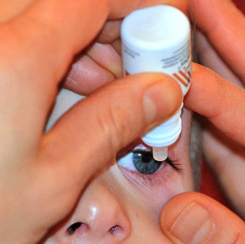 Seguir as orientações de higiene, respeitar o tempo de uso indicado e realizar consultas regulares ao oftalmologista são medidas fundamentais para quem deseja aproveitar os benefícios das lentes de contato sem comprometer a saúde dos olhos.