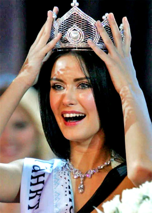 Sofia Rudieva (2009) - A Miss Rússia balançou no cargo quando fotos eróticas dela vazaram na imprensa. Mas, ainda assim, ela pôde participar do Miss Universo.  