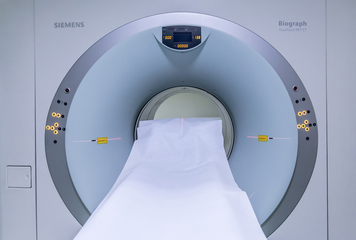 Em outro experimento, 32 voluntários foram submetidos a exames de ressonância magnética enquanto ouviam os sons dos apitos e outros ruídos.