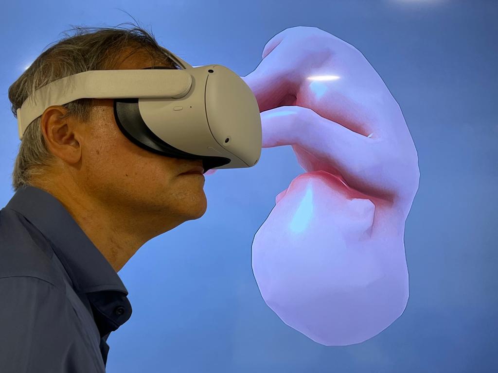 A partir daí, o especialista ganha tempo para propor soluções, como as cirurgias que ocorrem ainda na barriga das mães, ou pelo menos para amenizar a ansiedade das famílias.