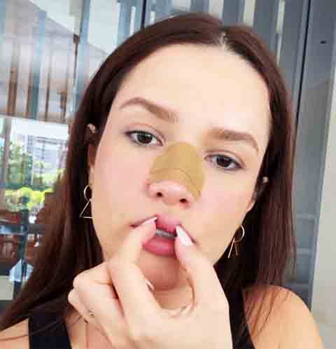 Ela compartilhou o ocorrido com bom humor nas redes sociais, tranquilizando seus fãs.  A cantora disse que improvisou uma fita modeladora para fazer um curativo.
