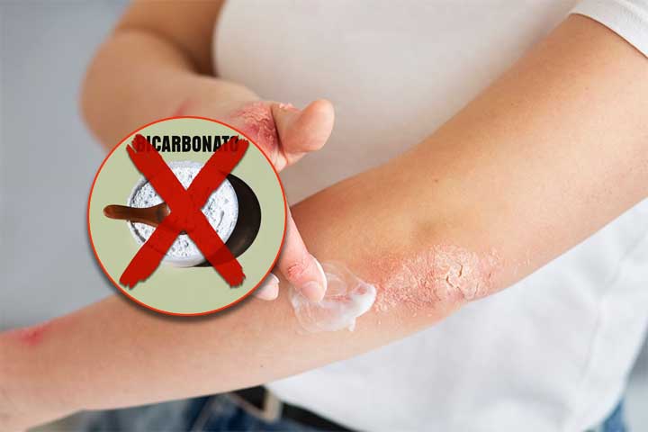 Em ferimentos na pele: aplicar bicarbonato de sódio em ferimentos, cortes ou queimaduras pode causar irritação e agravar a lesão. Nessas situações, é preferível lavar a área com água limpa e usar antissépticos adequados.