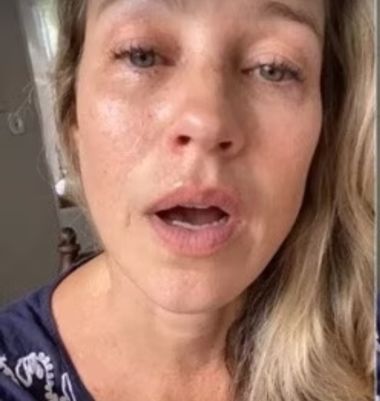 “Quem vai pagar? Esse menino precisa de um prótese. É a governador, Raquel Lyra? Ou o dirigente da política do Estado de Pernambuco? Ou ninguém vai fazer nada e vai ficar por isso mesmo?”, questionou Luana, emocionada. No vídeo, ela prometeu que se as autoridades não derem ao ambulante um prótese, ela mesma o fará.

