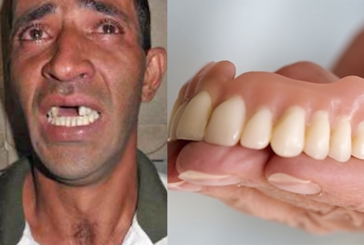 No município de Severínia, em São Paulo, o ladrão esqueceu a dentadura e acabou sendo identificado. Um suspeito foi detido e a dentadura coube com perfeição.