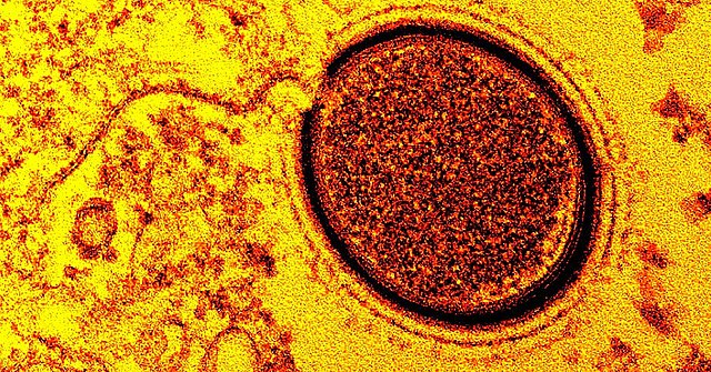 Mollivirus sibericum: Este vírus foi localizado em uma amostra de permafrost siberiano com cerca de 30.000 anos de idade.