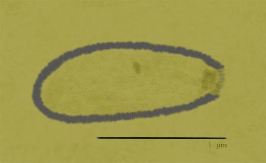 Pithovirus: Foram encontrados dois tipos deste vírus no permafrost: o primeiro, chamado de pithovirus mammoth, foi encontrado na mesma amostra pré-histórica de pelos do mamute.
