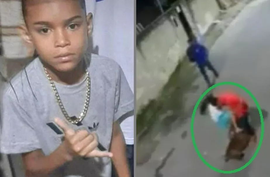 Nicolas Paz, de 10 anos, teve a panturrilha dilacerada por um pitbull que, segundo moradores, foi abandonado na rua e passou a atacar pessoas na Baixada Fluminense.