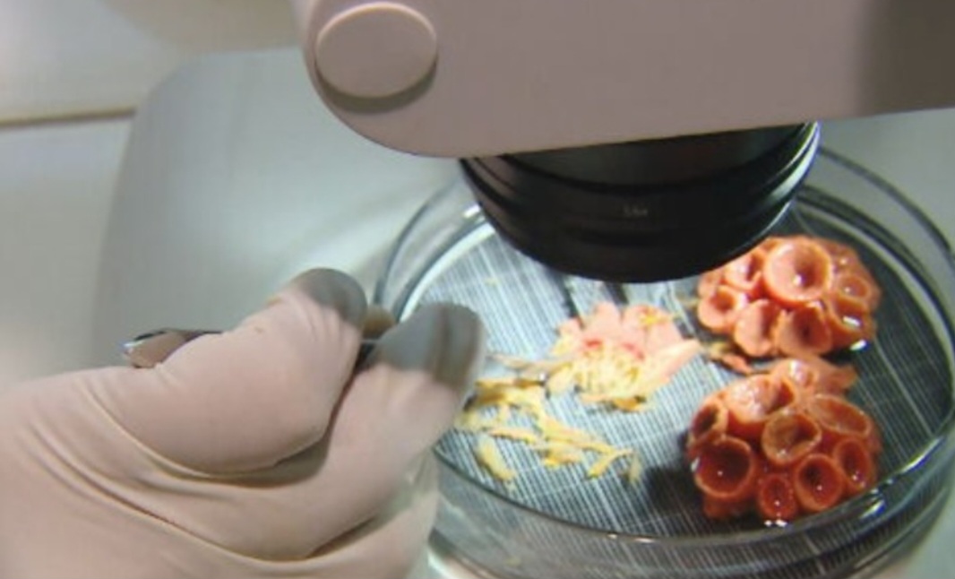 O material recolhido é levado para análise nos laboratórios na Universidade Federal de Santa Catarina (UFSC), que mantém parceria comInstituto Chico Mendes de Conservação da Biodiversidade (ICMBio).