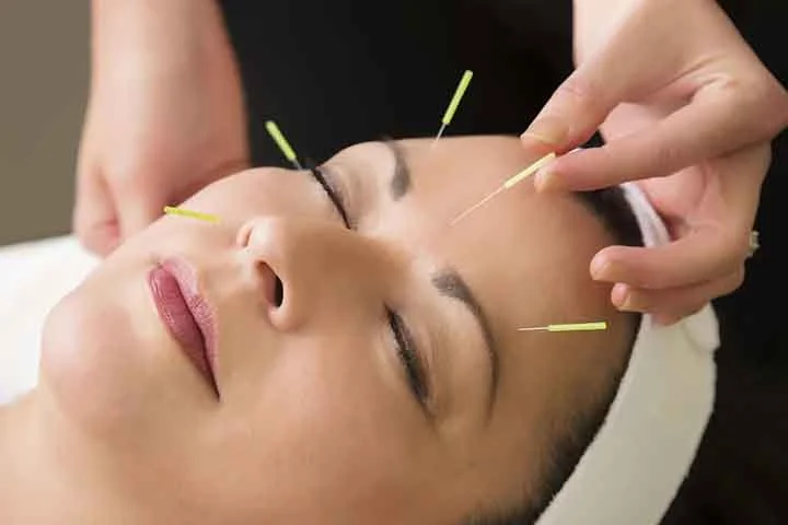 A acupuntura é uma técnica terapêutica da medicina tradicional chinesa que consiste na aplicação de agulhas em pontos específicos do corpo para estimular o equilíbrio energético e tratar diversas condições de saúde.