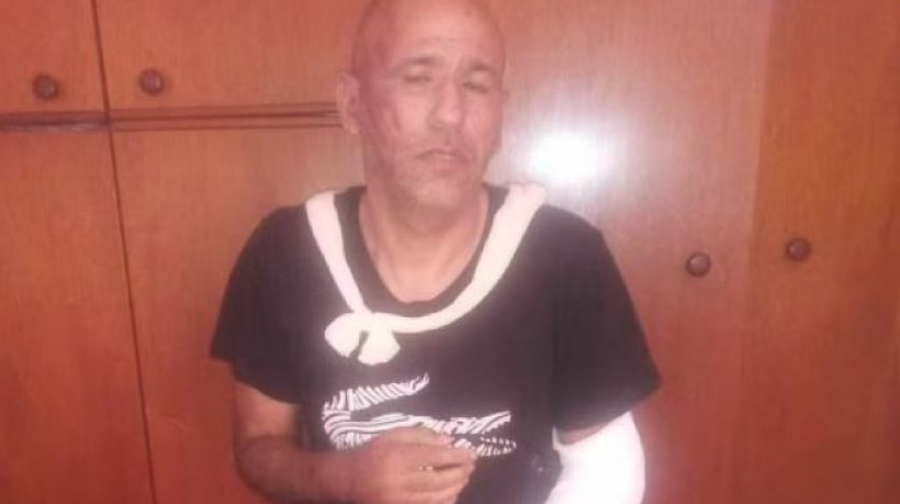 Renato Medeiros diz que ainda sofre sequelas das supostas agressões