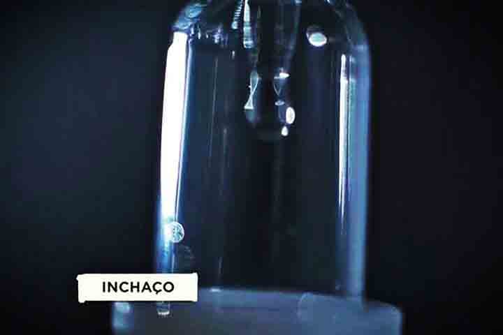 Essa superprodução de cortisol levou Sabrina a sofrer com a Síndrome de Cushing - doença endócrina provocada por elevados níveis do hormônio no organismo.