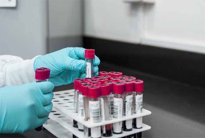 Elas também atuam na redução dos níveis de colesterol LDL, também conhecido como o colesterol “ruim” e
ajudam a regular os níveis de açúcar no sangue, fator importante para quem possui quadro de diabetes, sobretudo a mellitus (tipo 2).

