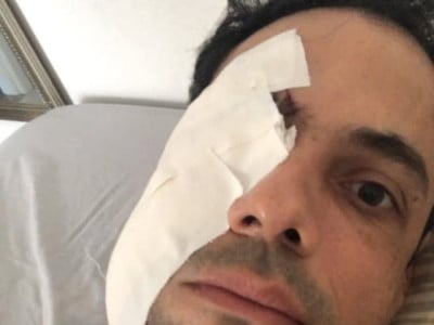 O empres&aacute;rio Bruno Rugue foi agredido enquanto trabalhava em um evento. A Pol&iacute;cia Civil investiga o caso (Foto: reprodu&ccedil;&atilde;o/redes sociais )