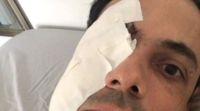 O empresário Bruno Rugue foi agredido enquanto trabalhava em um evento. A Polícia Civil investiga o caso 