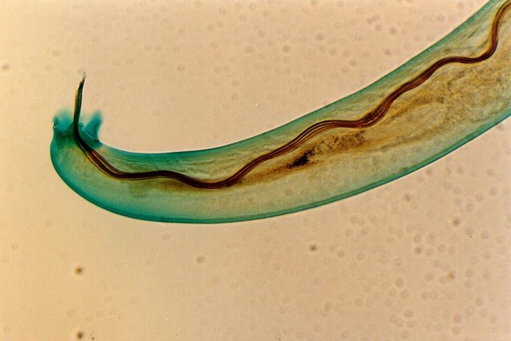 A causa foi a infecção pelo parasita Angiostrongylus cantonensis, conhecido como verme do pulmão de rato, comum em regiões tropicais e subtropicais. 
