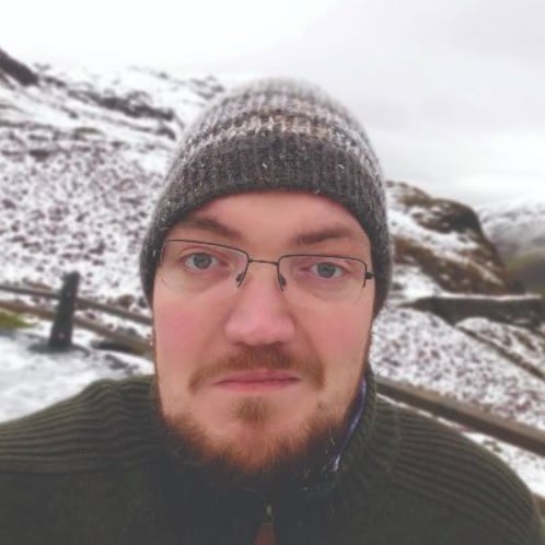 Desde pequeno, Tim já apresentava sinais incomuns. Aos dois anos, seu rosto ficou torto de forma repentina, o que inicialmente foi confundido pelo pai com uma brincadeira. 