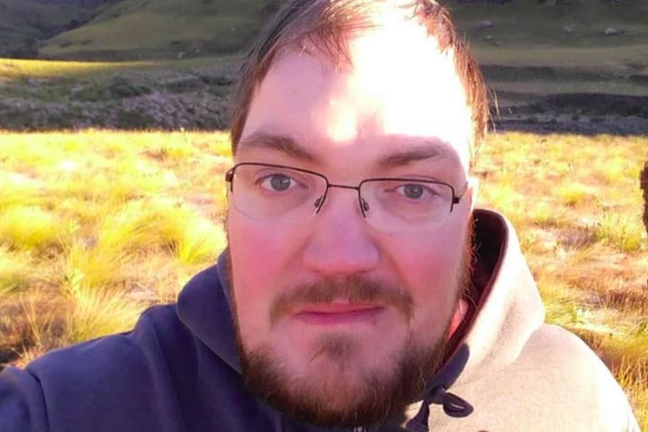 Timothy Dreyer nasceu com uma mutação genética extremamente rara – a esclerosteose – que afeta menos de 100 pessoas no mundo.