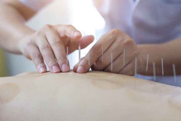 No Ocidente, países como Estados Unidos, Alemanha, França e Brasil também adotaram a acupuntura, com reconhecimento crescente na medicina integrativa e complementar. A OMS recomenda sua prática em diversos contextos clínicos.