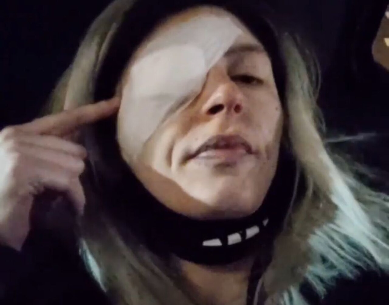 'Escolhi remover meu olho porque eu queria sobreviver por meus filhos', afirma Bree.