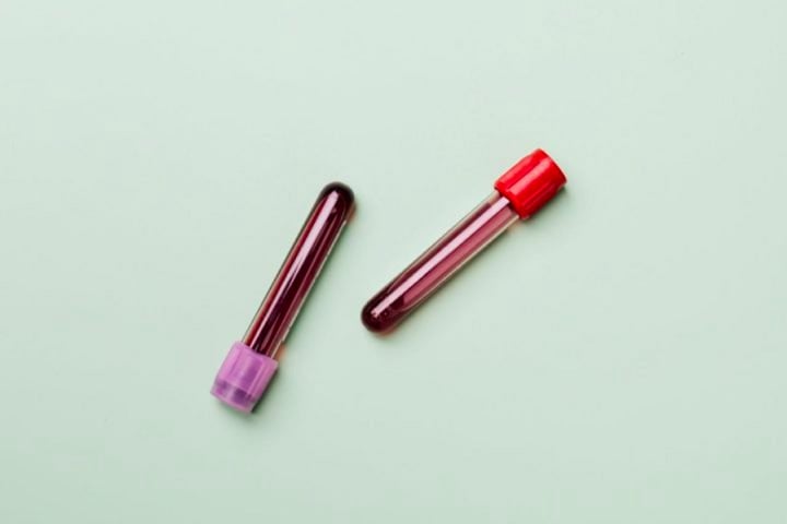 Na Austrália, ele era conhecido como o homem do braço de ouro devido à presença de um anticorpo raro em seu sangue, o Anti-D. 