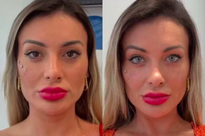 No Brasil, a cirurgia só é permitida em casos específicos, como para pacientes que já perderam a visão devido a doenças graves. 