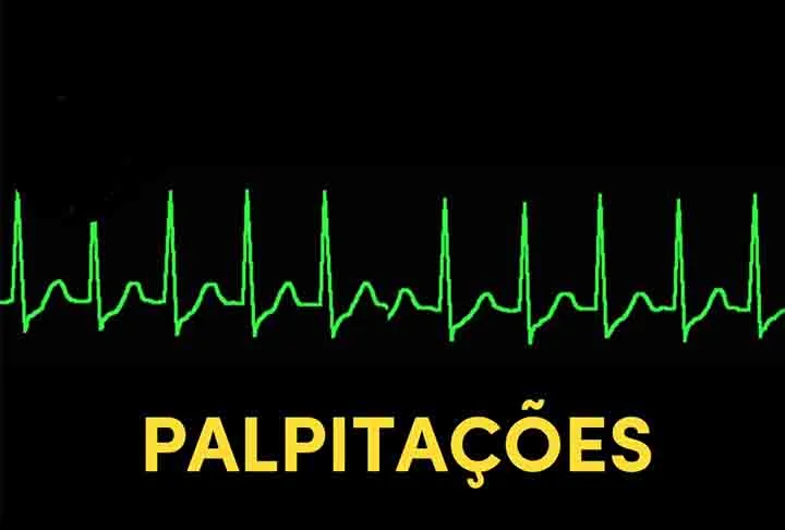 É preciso destacar que boa parte das arritmias não tem uma causa bem definida, sendo algumas de nascença. Outras são em virtude de problemas no músculo do coração, como infarto, insuficiência cardíaca ou doença de Chagas. 