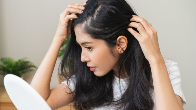 Cuidados simples ajudam a tratar a caspa sem agredir os cabelos (Imagem: Kmpzzz | Shutterstock) 