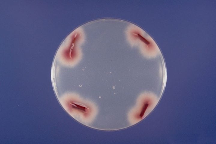 Fusarium oxysporum é um fungo filamentoso amplamente distribuído no solo e conhecido por sua capacidade de causar doenças em uma grande variedade de plantas.