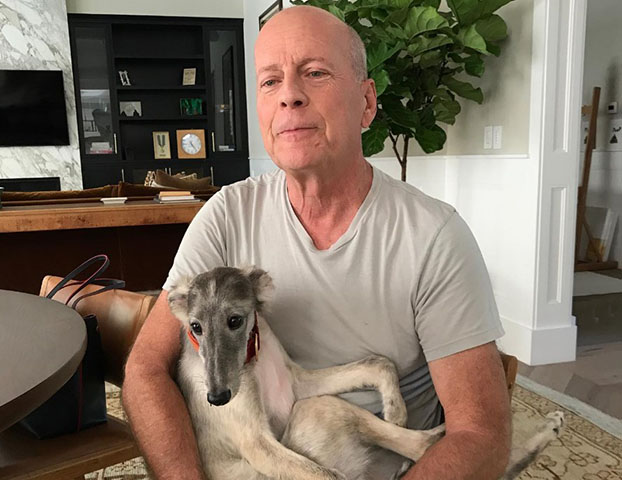 Os fãs dw Bruce Willis, um dos astros mais famosos de Hollywood, se surpreenderam e ficaram comovidos na época da divulgação da noticia sobre a demência do ator.
