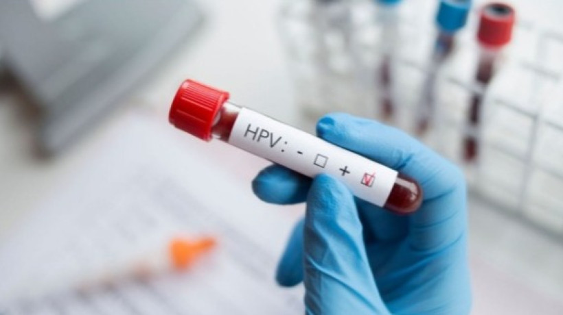 O papilomavírus humano é a infecção sexualmente transmissível (IST) mais comum