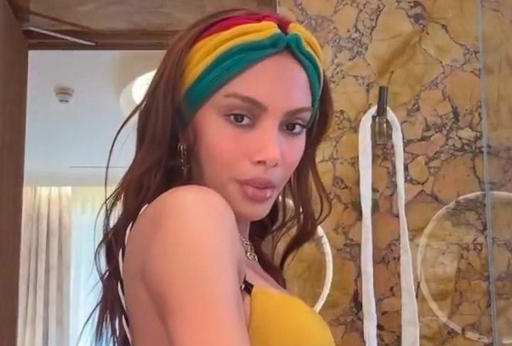 Saíram notas na imprensa dizendo que eu estava desfigurada, que voltei dos Estados Unidos com um dreno no rosto por causa de uma emergência, que peguei uma bactéria numa cirurgia... algo que, se fosse verdade, seria muito sério.