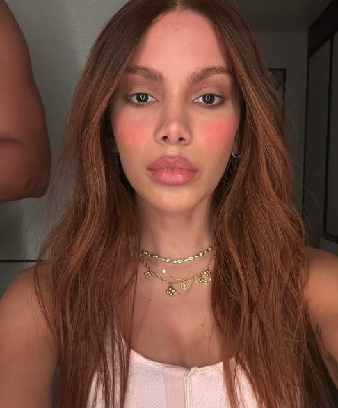 No dia 1/7, Anitta publicou uma foto no Instagram exibindo seu novo rosto, mas acabou limitando os comentários por conta da repercussão negativa.