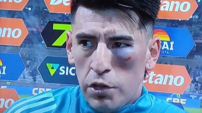 Jogador recebeu uma pancada no rosto no segundo tempo e optou por seguir em campo